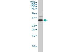 Western Blotting (WB) image for anti-Sprouty Homolog 2 (SPRY2) (AA 1-316) antibody (ABIN599124) (SPRY2 antibody  (AA 1-316))