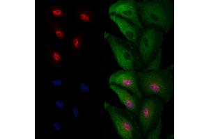 ABIN6265255 and ABIN6277135 staining  cells by IF/ICC.