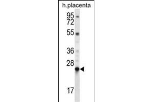 LHFPL1 Antibody (N-term) (ABIN657121 and ABIN2837897) western blot analysis in human placenta tissue lysates (35 μg/lane). (LHFPL1 antibody  (N-Term))