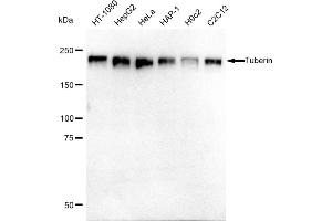 Western blotting analysis using Tuberin antibody (ABIN7800657). (Recombinant Tuberin antibody)