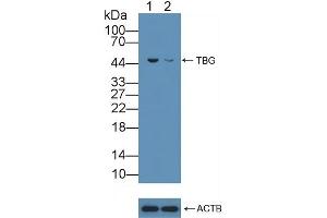 anti-Serpin Family A Member 7 (SERPINA7) (AA 128-415) antibody