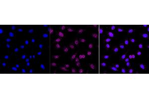 Immunocytochemical staining of C2C12 cells with DNA polymerase beta antibody (ABIN7799875), 1:1,000).