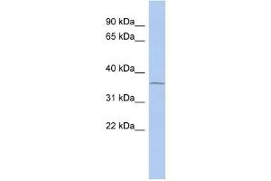 WB Suggested Anti-UPP1 Antibody Titration:  0. (UPP1 antibody  (Middle Region))