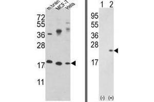 Image no. 1 for anti-Cofilin 1 (CFL1) (N-Term) antibody (ABIN452840) (Cofilin antibody  (N-Term))