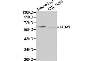 Western blot analysis of extracts of various cell lines, using MTM1 antibody (ABIN5970085) at 1/1000 dilution. (MTM1 antibody)