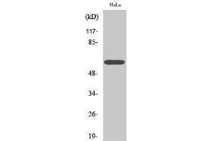 Western Blotting (WB) image for anti-Cell Division Cycle 6 Homolog (S. Cerevisiae) (CDC6) (Ser219) antibody (ABIN3183825) (CDC6 antibody  (Ser219))