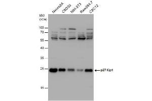 WB Image p27 Kip1 antibody detects p27 Kip1 protein by western blot analysis.