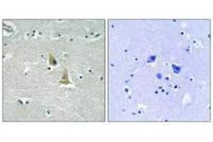 Immunohistochemistry analysis of paraffin-embedded human brain tissue using p47 phox (Ab-345) antibody. (NCF1 antibody  (Ser345))