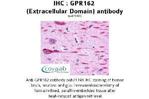 Image no. 1 for anti-G Protein-Coupled Receptor 162 (GPR162) (1st Extracellular Domain) antibody (ABIN1734984)