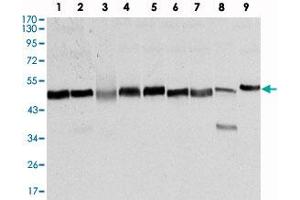 Western blot analysis using FOXD3 monoclonal antibody, clone 5G9  against NTERA-2 (1) , HUVE-12 (2) , HEK293 (3) , HeLa (4) , Jurkat (5) , K-562 (6) , RAW264. (FOXD3 antibody)