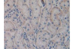 Immunohistochemistry (IHC) image for anti-Toll-Like Receptor 4 (TLR4) (AA 49-247) antibody (ABIN7432529)