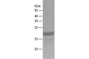 Western Blotting (WB) image for TRAF-Interacting Protein with Forkhead-Associated Domain (TIFA) (AA 1-184) protein (His tag) (ABIN7288284) (TIFA Protein (AA 1-184) (His tag))