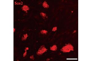 Sox2 antibody (pAb) tested by Immunofluorescence. (SOX2 antibody  (C-Term))