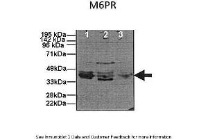 Human, Mouse (M6PR antibody  (N-Term))