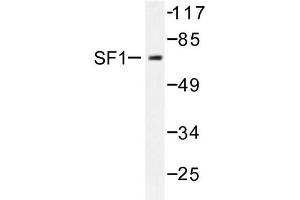 Image no. 1 for anti-Nuclear Receptor Subfamily 5, Group A, Member 1 (NR5A1) antibody (ABIN272078) (NR5A1 antibody)