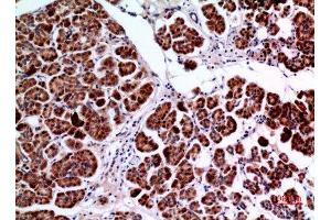 Immunohistochemistry (IHC) analysis of paraffin-embedded Human Pancreas, antibody was diluted at 1:100.