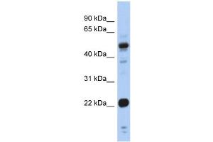 WB Suggested Anti-CSRP1 Antibody Titration:  0. (CSRP1 antibody  (Middle Region))