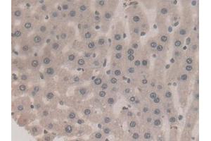 Detection of F2 in Rat Liver Tissue using Monoclonal Antibody to Coagulation Factor II (F2) (Prothrombin antibody  (AA 44-200))