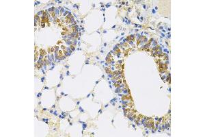 Immunohistochemistry of paraffin-embedded mouse lung using CEACAM5 antibody.