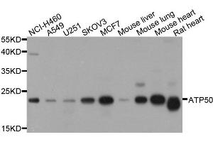 Western blot analysis of extract of various cells, using ATP5O antibody. (ATP5O antibody)