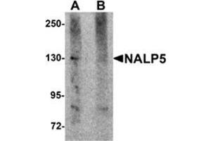 Western blot analysis of NALP5 in mouse brain tissue lysate with NALP5 antibody at 1 μg/ml in (A) the absence and (B) the presence of blocking peptide. (NLRP5 antibody  (C-Term))