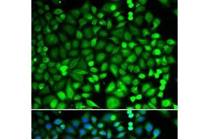 Immunofluorescence analysis of MCF-7 cells using PSMB2 Polyclonal Antibody (PSMB2 antibody)