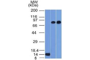 Western Blot of Recombinant, PC3 and HeLa cell lysates using p63 Mouse Monoclonal Antibody (TP63/1786).
