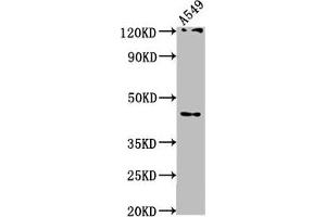 Western Blot Positive WB detected in: A549 whole cell lysate All lanes: AIFM2 antibody at 1:1000 Secondary Goat polyclonal to rabbit IgG at 1/50000 dilution Predicted band size: 41, 37 kDa Observed band size: 41 kDa (AIFM2 antibody  (AA 110-373))