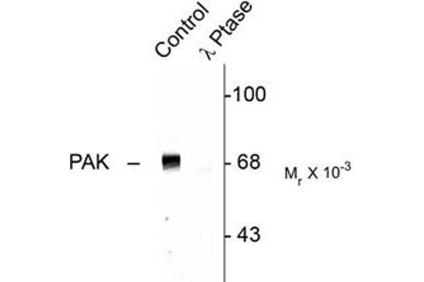 PAK1/2/3 antibody  (pThr423)