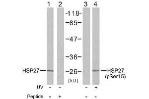 Image no. 2 for anti-Heat Shock 27kDa Protein 1 (HSPB1) (pSer15) antibody (ABIN196895) (HSP27 antibody  (pSer15))
