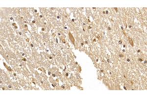 Detection of DCLK1 in Human Cerebrum Tissue using Monoclonal Antibody to Doublecortin Like Kinase 1 (DCLK1) (DCLK1 antibody  (AA 390-647))