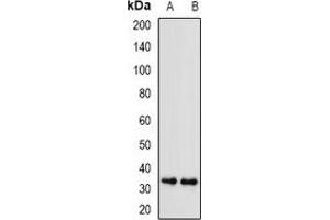 Western blot analysis of SGTA expression in A549 (A), U251 (B) whole cell lysates. (SGTA antibody)
