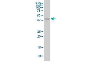 DDO polyclonal antibody (A01). (DDO antibody  (AA 270-369))