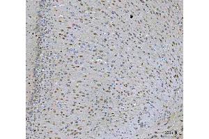 IHC analysis of PRMT5 using anti-PRMT5 antibody (ABIN7600176).