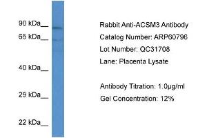 Western Blotting (WB) image for anti-Acyl-CoA Synthetase Medium-Chain Family Member 3 (ACSM3) (N-Term) antibody (ABIN2788586) (ACSM3 antibody  (N-Term))