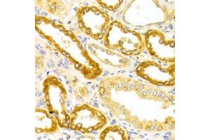 Immunohistochemistry of paraffin-embedded Human kidney using OLR1 antibody at dilution of 1:100 (x400 lens).