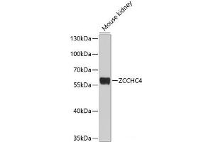 Western blot analysis of extracts of Mouse kidney using ZCCHC4 Polyclonal Antibody at dilution of 1:1000. (ZCCHC4 antibody)