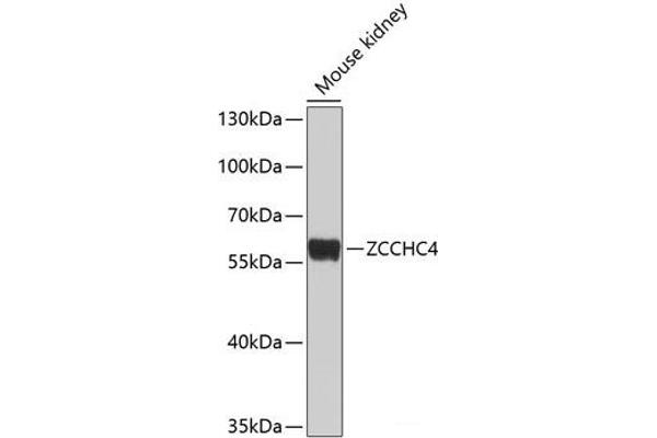 ZCCHC4 抗体