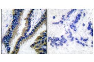 Immunohistochemistry (IHC) image for anti-Vav 1 Oncogene (VAV1) (Tyr174) antibody (ABIN1848166) (VAV1 antibody  (Tyr174))