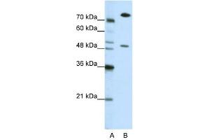 WB Suggested Anti-SSB Antibody Titration: 0. (SSB antibody  (N-Term))