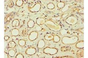 Immunohistochemistry of paraffin-embedded human kidney tissue using ABIN7145241 at dilution of 1:100 (BBS4 antibody  (AA 350-519))