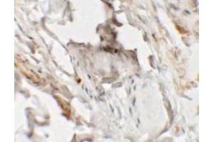 Immunohistochemistry of HHATL in human skin tissue with HHATL antibody at 2. (HHATL antibody  (N-Term))