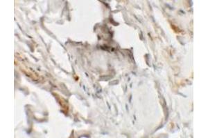 Immunohistochemistry of HHATL in human skin tissue with HHATL antibody at 2. (HHATL antibody  (N-Term))