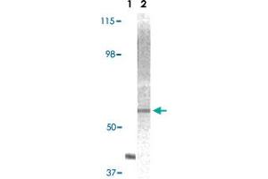 Western blot analysis using AKT2 monoclonal antibody, clone 1G8C12  against truncated AKT2 recombinant protein (Lane 1) and A-431 cell lysate (Lane 2).