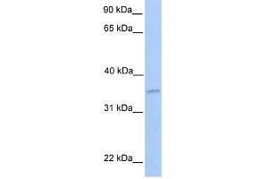 NKIRAS2 antibody used at 1 ug/ml to detect target protein.