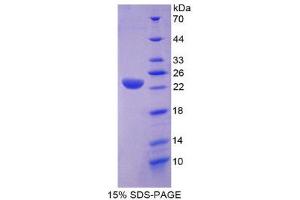 SDS-PAGE (SDS) image for Lipase A, Lysosomal Acid, Cholesterol Esterase (LIPA) (AA 32-201) protein (His tag) (ABIN2125684)