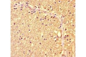 Immunohistochemistry of paraffin-embedded human brain tissue using ABIN7175986 at dilution of 1:100 (ZBTB46 antibody  (AA 174-362))