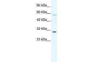 Human K562; WB Suggested Anti-GATAD1 Antibody Titration: 0. (GATAD1 antibody  (C-Term))