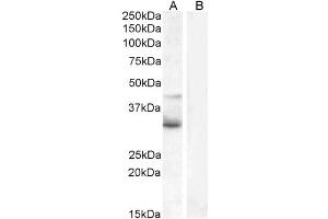 ABIN184715 (1µg/ml) staining of Jurkat (A) and negative control U937 (B) cell lysate (35µg protein in RIPA buffer). (WNT4 antibody  (Internal Region))
