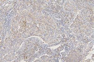 IHC analysis of SFRP1 using anti-SFRP1 antibody (ABIN6719484). (SFRP1 antibody)